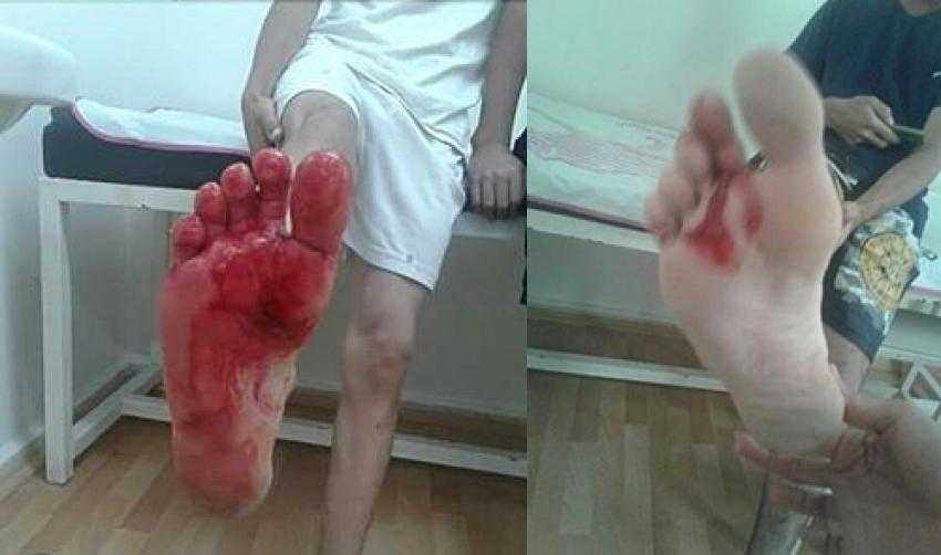 IŞIKLI'DA HER GÜN AYAK KESİĞİ OLUYOR